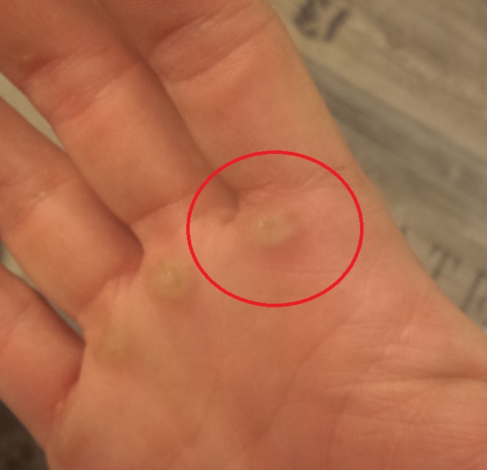 Hand.jpg