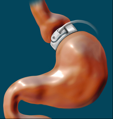 Breibandsonde.jpg